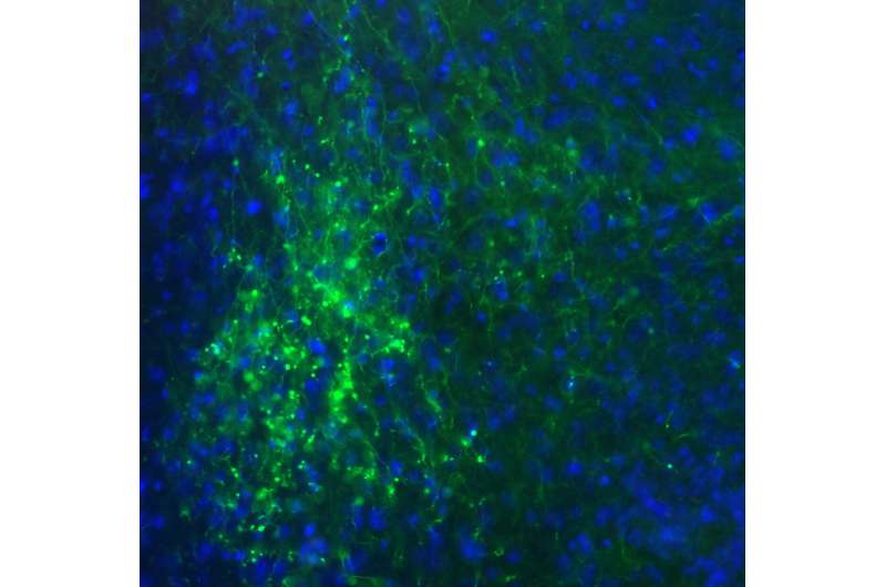 Secret structure in the wiring diagram of the brain