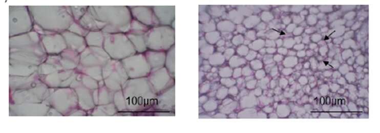 Flavor your food with 'flavanols' to burn excess fat, new study suggests