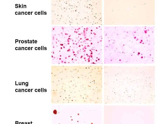 Inhibiting SAM biosynthesis to slow tumor growth