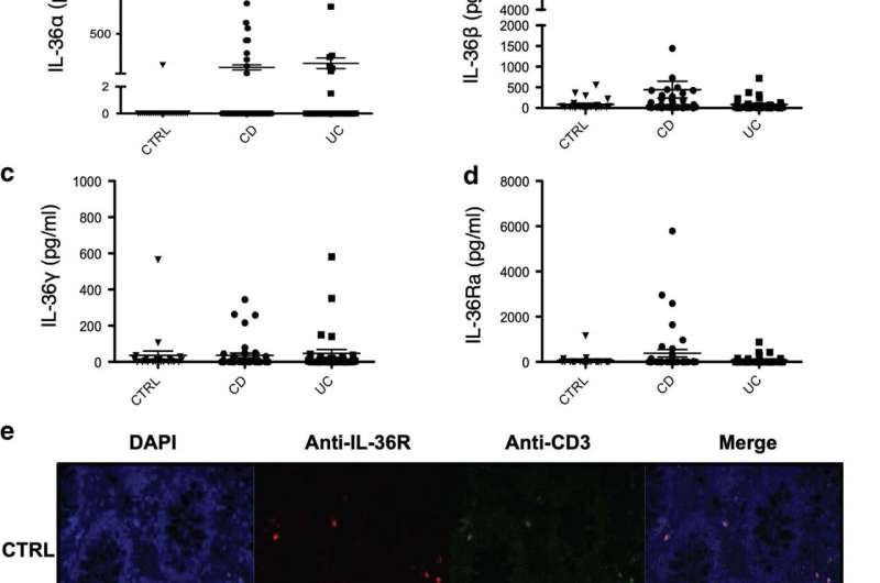 New therapeutic options for childhood inflammatory bowel disease 