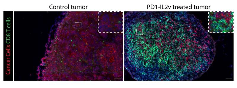 Drug combo breaks down cancer resistance to immunotherapy