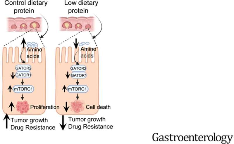 Dietary change starves cancer cells, overcoming treatment resistance