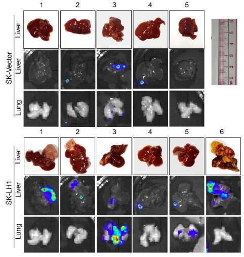 Researchers identify a protein that promotes cancer metastasis, providing a new potential treatment target