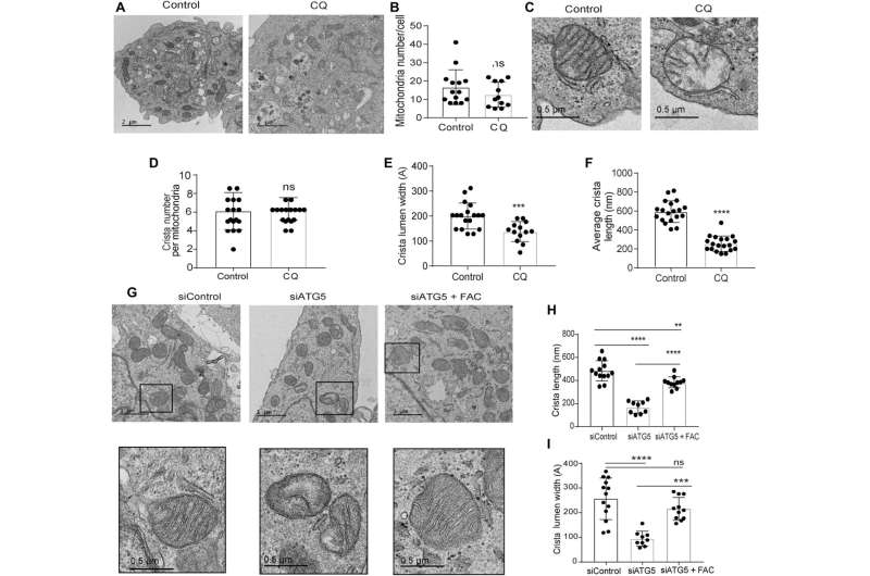 Inhibiting the biological crosstalk of autophagy and mitochondrial function underlying pancreatic ductal adenocarcinoma