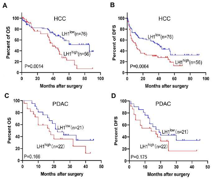 Researchers identify a protein that promotes cancer metastasis, providing a new potential treatment target