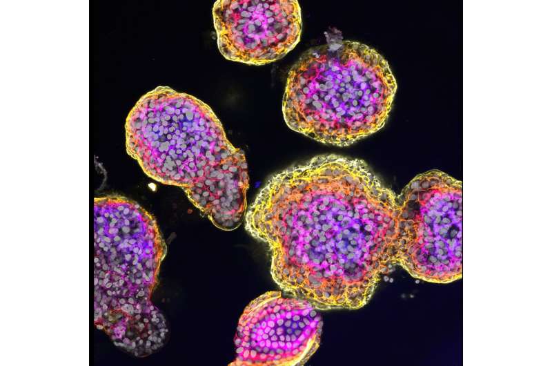 New insights into liver cancer using organoids 