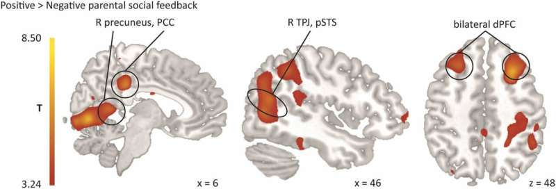 Parental criticism hurts: A glimpse inside the adolescent brain 