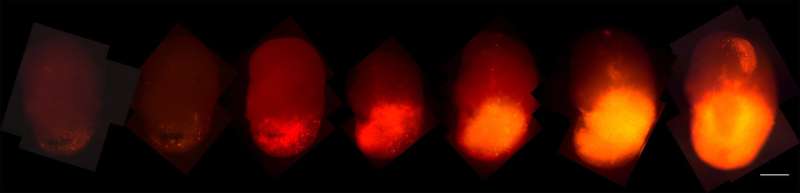 Scientists develop a new model for glioblastoma using gene-edited organoids 