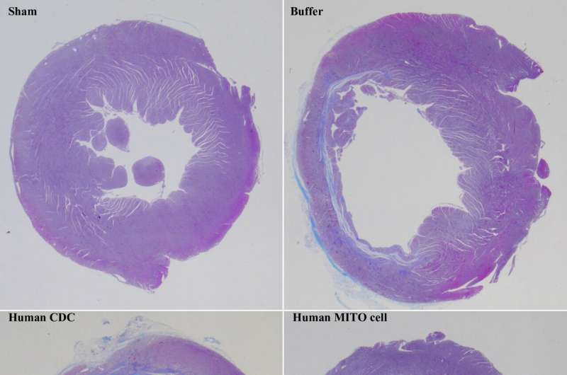 Mitochondrial activation in transplanted cells promotes regenerative therapy for heart healing