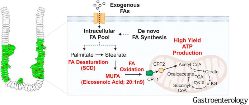 Fatty acids rewire energy supply chain in stomach cancer development, study shows