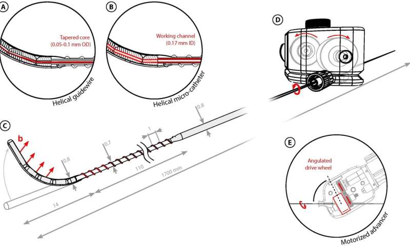 Magnetically operated robot can move through arteries to treat stroke patients