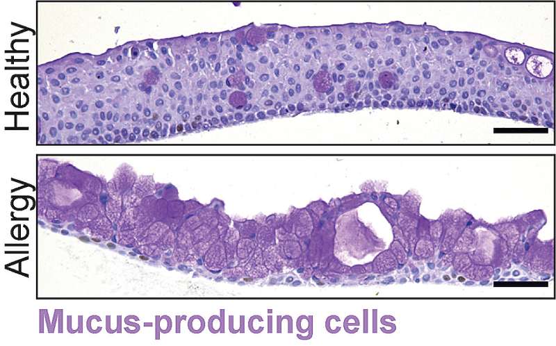 Producing tears in a dish: researchers develop first model of human conjunctiva