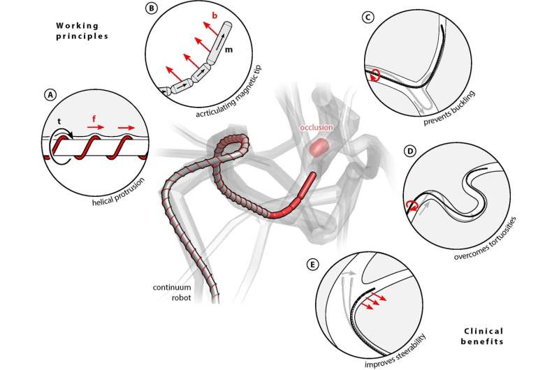 Magnetically operated robot can move through arteries to treat stroke patients