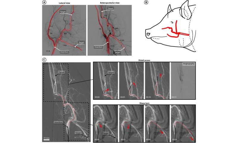 Magnetically operated robot can move through arteries to treat stroke patients