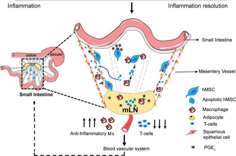 New study on promising stem cell-based therapy for Crohn's disease