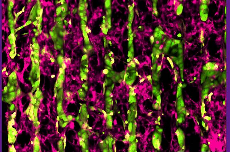 Engineered heart cells may improve understanding of atrial fibrillation