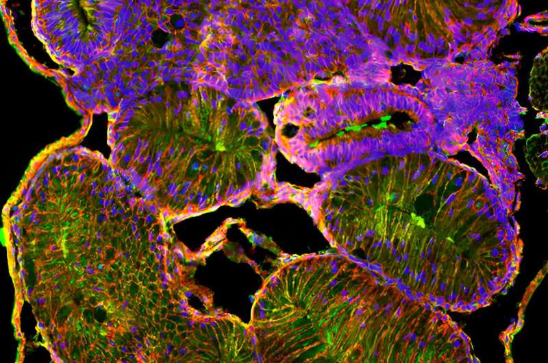 Frog embryo study helps scientists unravel the human birth anomaly of intestinal malrotation