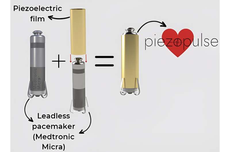 Q&A: Device harvests heartbeat energy to extend pacemaker battery life