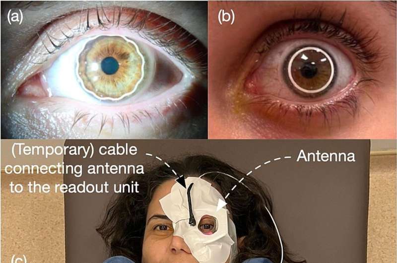 Contact lenses to diagnose glaucoma