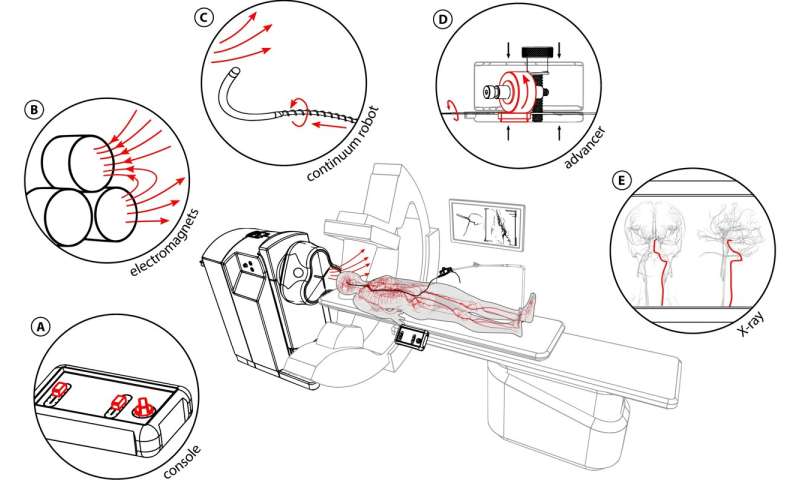 Magnetically operated robot can move through arteries to treat stroke patients