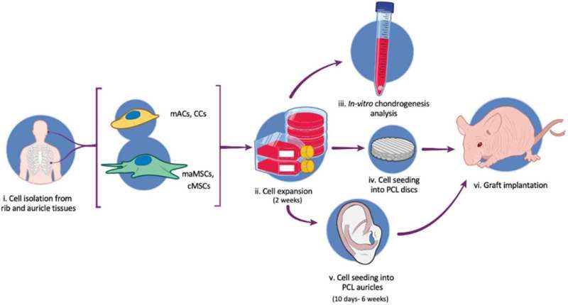 Customized implants for the rehabilitation of ear malformation 