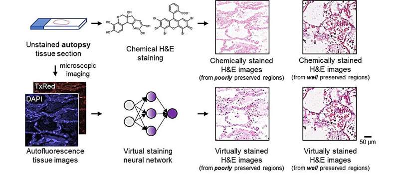 Virtual staining of unlabeled autopsy tissue using AI