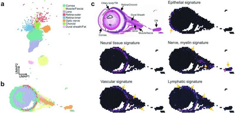 In fight against brain pathogens, the eyes have it