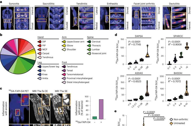 Fibroblast cells play a key role in resolving joint inflammation, new study finds