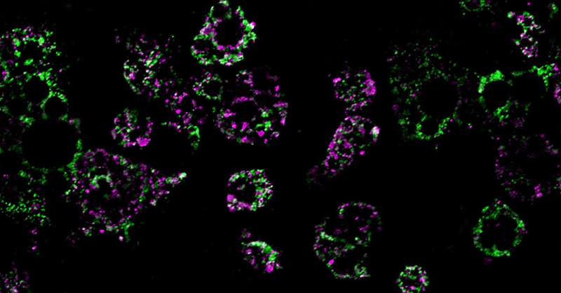 How obesity dismantles our mitochondria