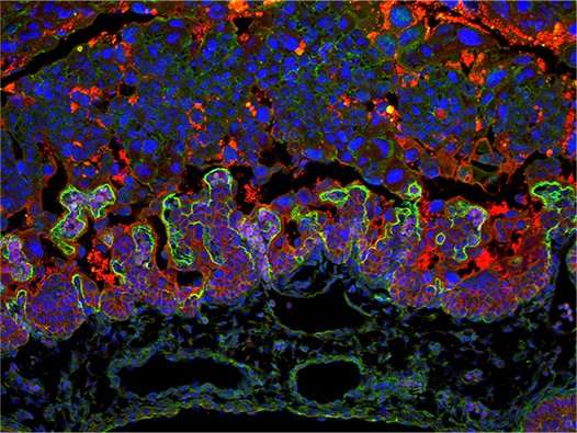 Alomst 70 percent of 103 genes linked to prenatal death affect the placenta 