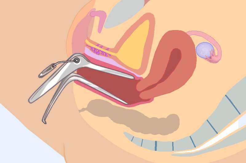 Speculum: the creepy history of this ancient gynaecological device and why it's still feared today