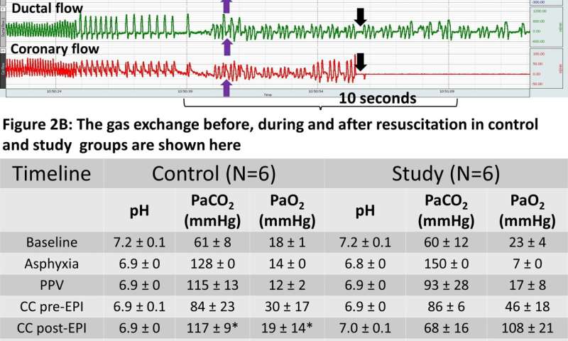 New study evaluates current neonatal resuscitation guidelines