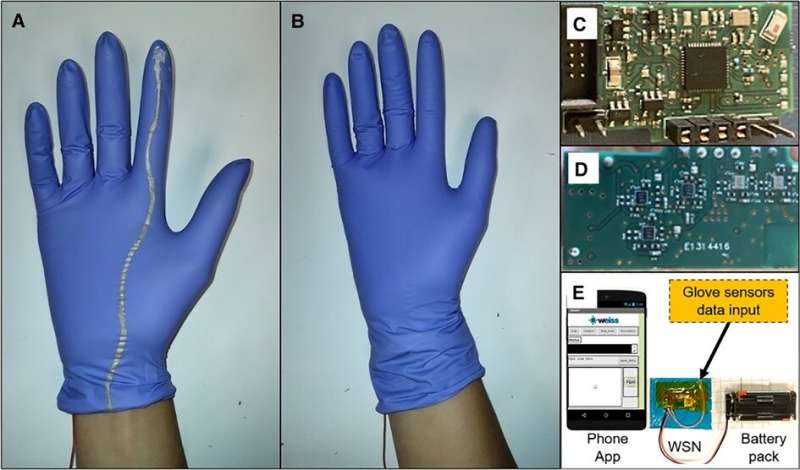 $1 smart glove could help prevent dangerous births by sensing fetal position 