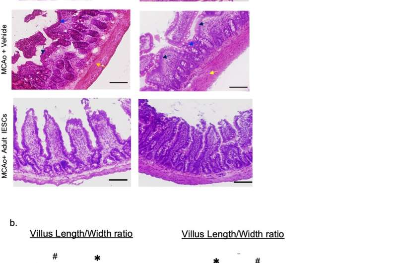 How repairing the gut saves brain function after stroke 