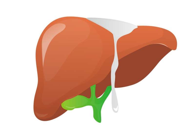 Fatty liver is increasingly the cause of liver cell cancer 