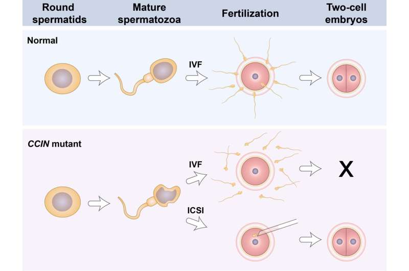 Mutations in CCIN cause teratozoospermia and male infertility 