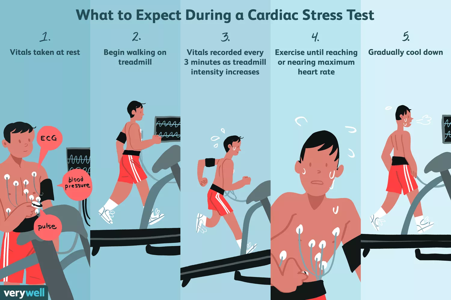 What Is a Cardiac Stress Test?