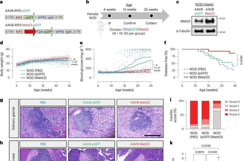 Shifting focus: Investigators describe changes to pancreatic β cells at onset of type 1 diabetes