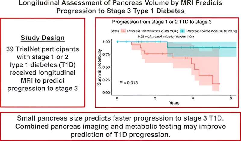 Study links small pancreas size to faster progression to stage 3 type 1 diabetes