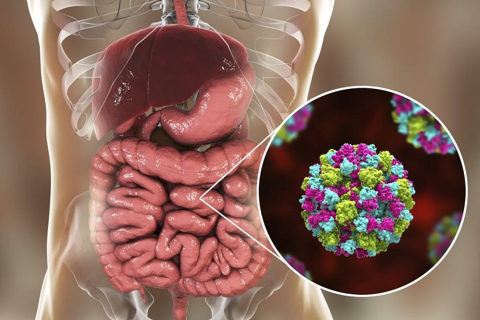 Gastroenteritis: tipos, causas, síntomas y tratamiento