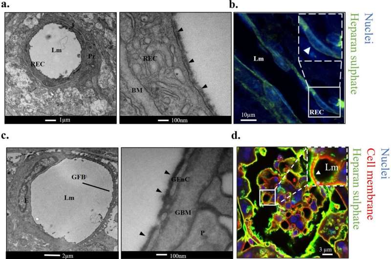 New drug could prevent diabetic eye and kidney disease in people with diabetes