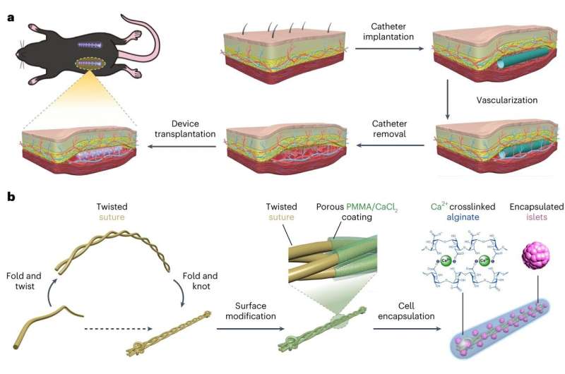 Under-the-skin implant could treat Type I diabetes