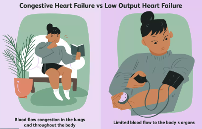 What Is Congestive Heart Failure?