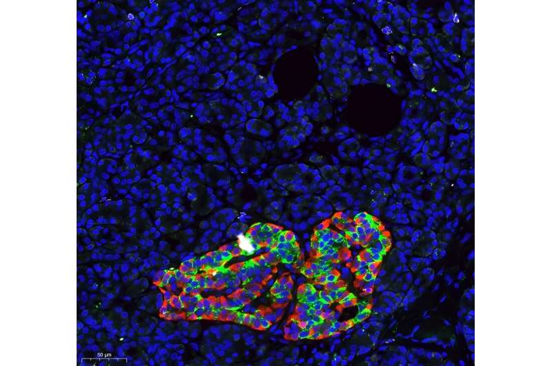 New DNA methylation-based method for precise assessment of pancreas cell composition