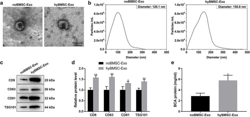 Healing diabetes wounds with a new superhero: Stem cell magic