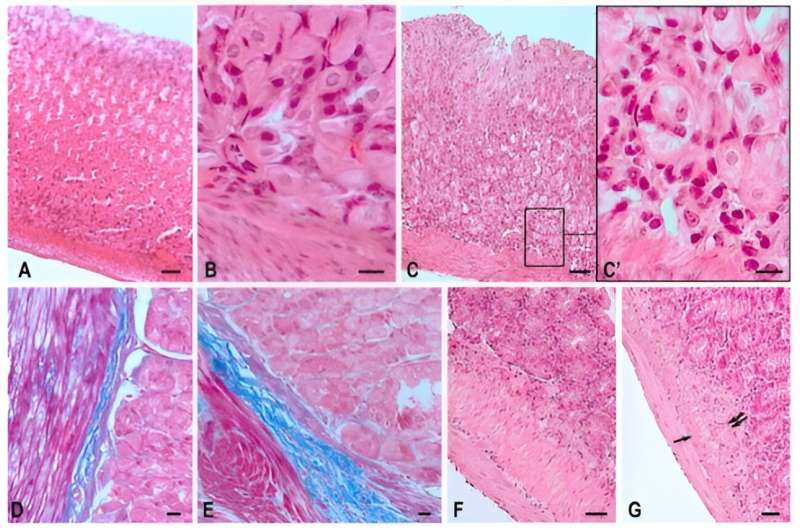 Fundus of the gastric wall and jejunum of the Mongolian gerbil Meriones unguiculatus. Technique: (A–C,F,G) Staining with hematoxylin and eosin; (D,E) Picro-Mallory staining protocol. (A–E) Morphology of the gastric wall in the control group (A,B,D) and in the space flight group (C,C’,E). (F,G) Morphology of the jejunal wall in the control group and in the space flight group (G). After an orbital flight occurs decreasing thickness of the (inner) circular layer muscularis externa (arrow), and proliferation of the connective tissue in the submucosa (double arrow). Scale bar: (A,C,F,G)—50 µm; (D,E)—20 µm; (B,C’)—10 µm. Credit: International Journal of Molecular Sciences (2023). DOI: 10.3390/ijms242216539