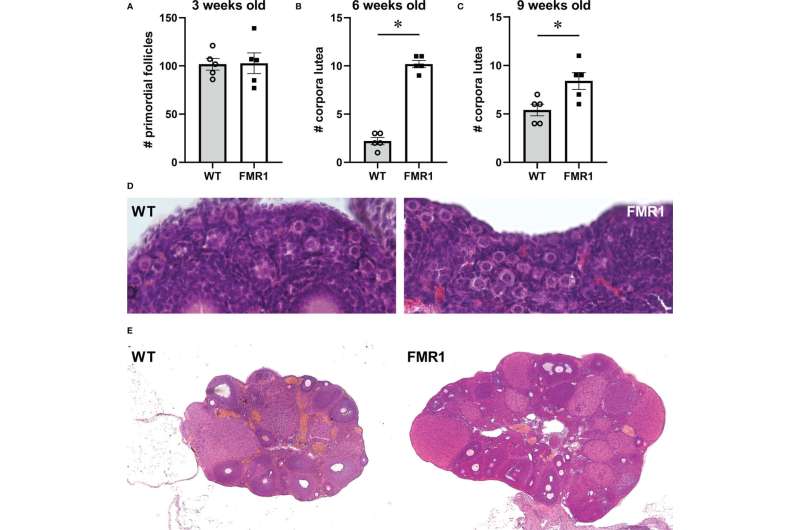 How an autism gene contributes to infertility