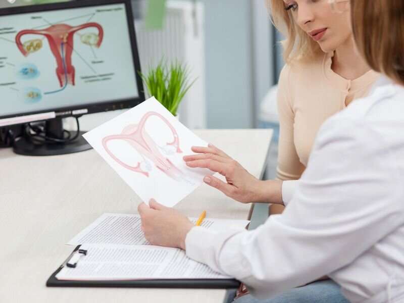 Hysterectomy: What it is, side effects and recovery 