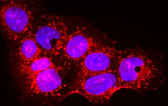 New therapeutic prospect for preeclampsia 