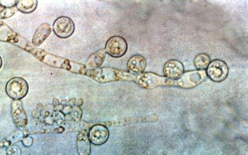 Candida albicans. Credit: Wikipedia.